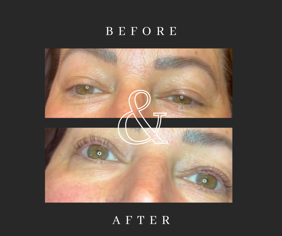 I tried an eyelash lift and tint and am sharing my honest review of the process and the results. Was it worth it? Everything you need to know.